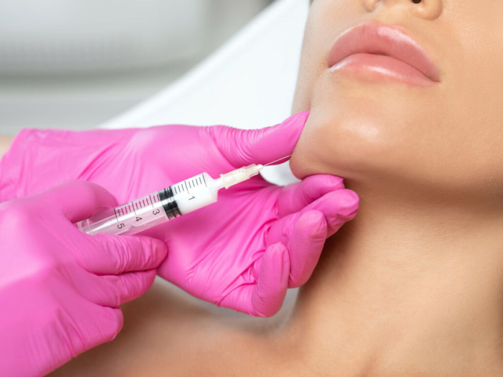 kybella for double chin